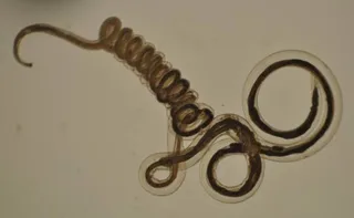 Nematodirus worm
